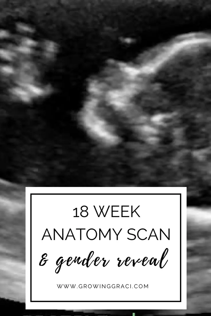 Going to your anatomy scan while pregnant can make even the bravest mom nervous. Read about my 18 week anatomy scan and my experience.