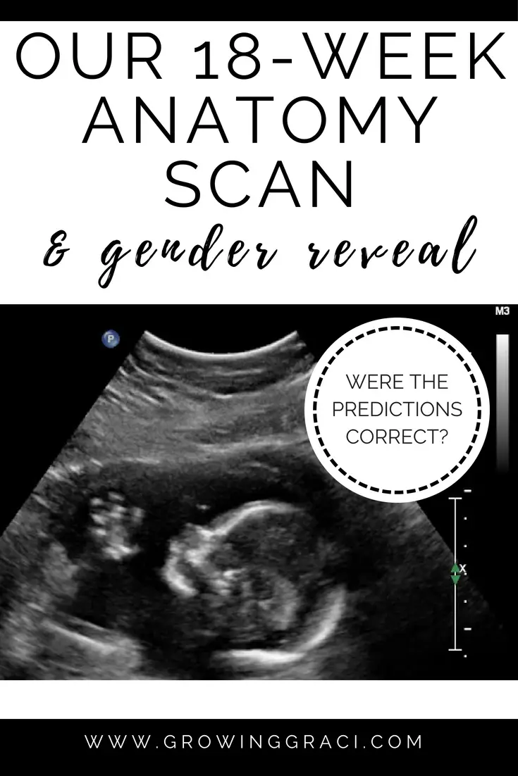 18 Week Anatomy Scan & Gender Confirmation